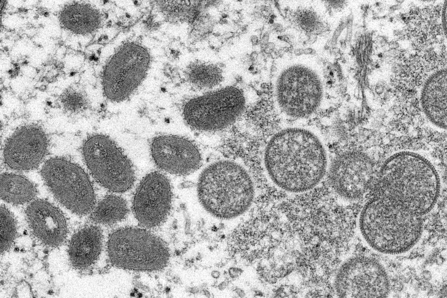 Diese elektronenmikroskopische Aufnahme aus dem Jahr 2003, die von den Centers for Disease Control and Prevention zur Verfügung gestellt wurde, zeigt reife, ovale Affenpockenviren (l) und k...