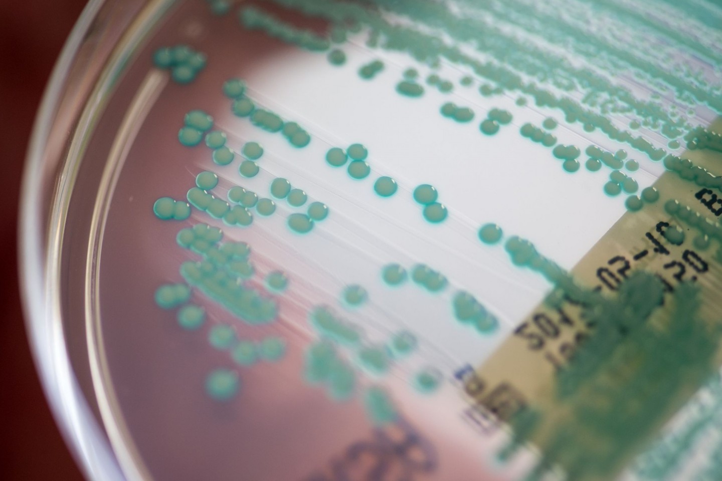 Eine Petrischale mit MRSA-Keimen (Methicillin-resistenten Staphylococcus aureus), aufgenommen im Universitätsklinikum Regensburg. (Archivbild)