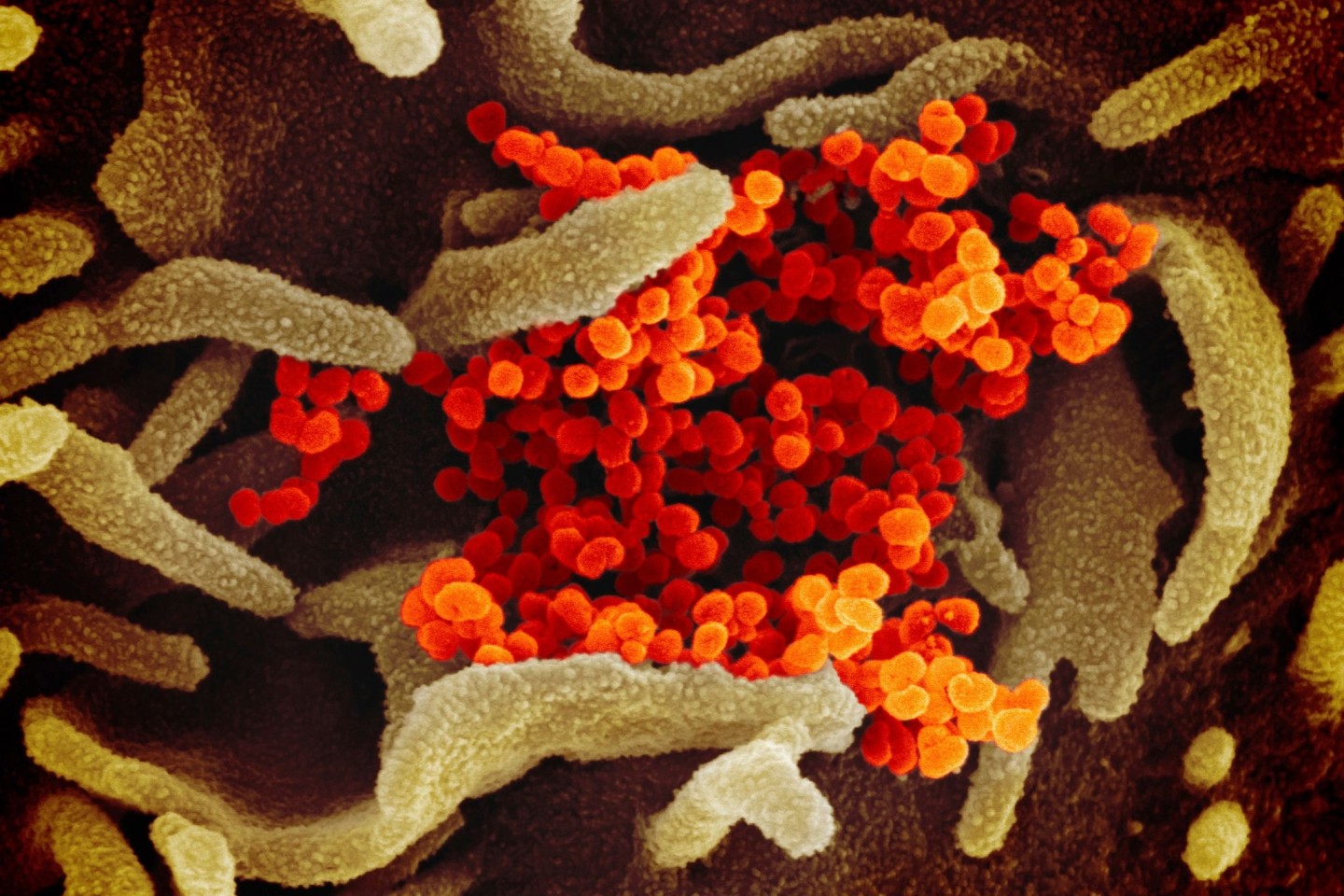 Das Coronavirus (SARS-CoV-2, orange) tritt aus der Oberfläche von im Labor kultivierten Zellen (grau) aus. Die Probe wurde von einem Patienten in den USA isoliert.