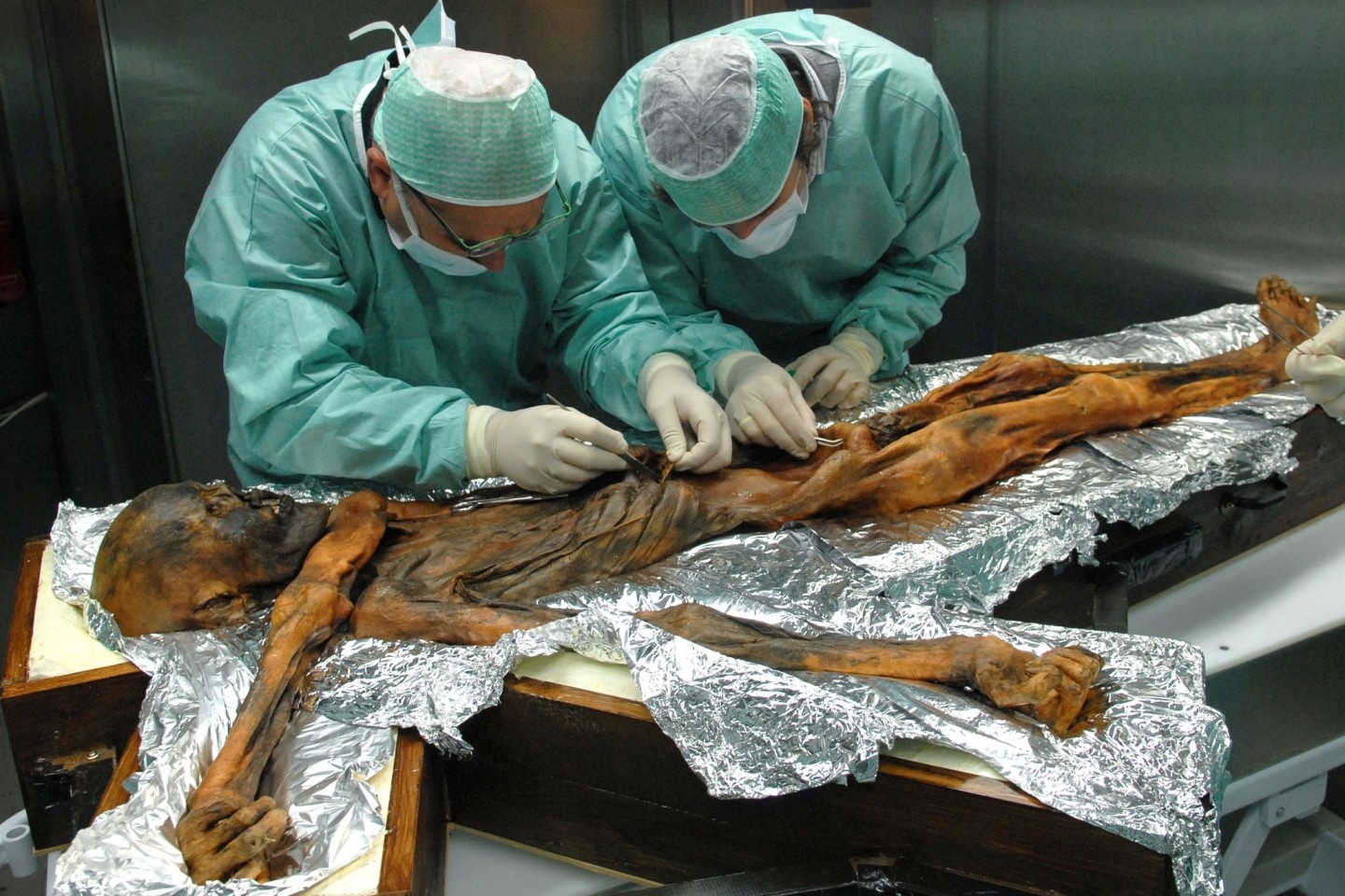 Wissenschaftler untersuchen in Bozen die rund 5000 Jahre alte Gletschermumie «Ötzi» und entnehmen Proben des Mageninhaltes.