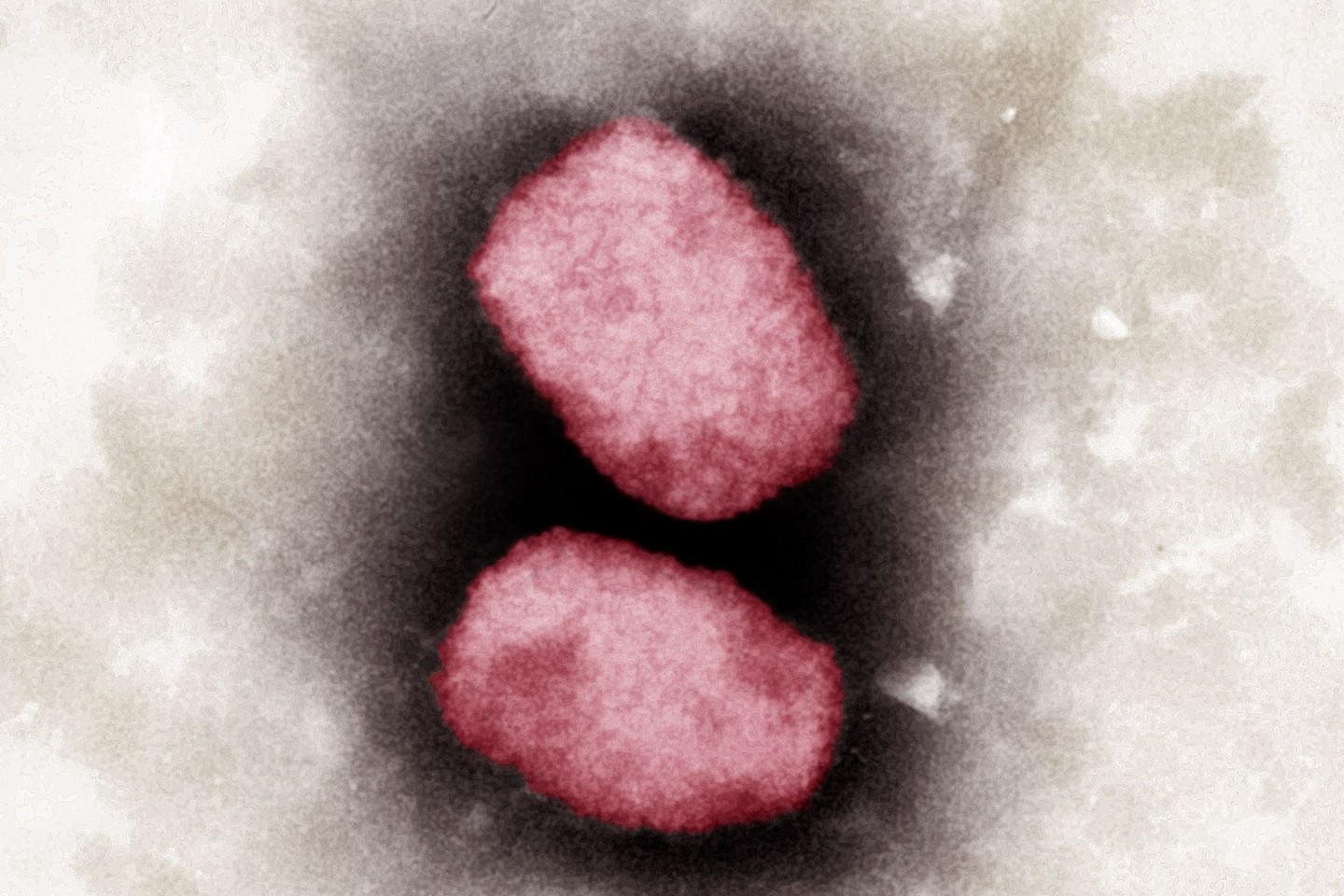 Elektronenmikroskopische Aufnahme von Affenpocken-Viren, koloriert (Bestmögliche Bildqualität).
