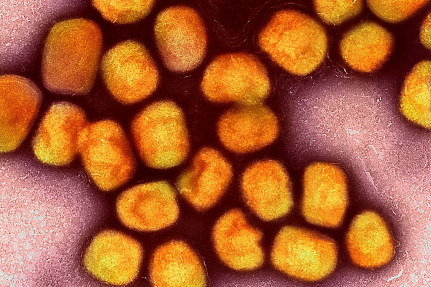 Eine kolorierte ektronenmikroskopische Aufnahme von Partikeln des Affenpockenvirus (Gold), kultiviert und gereinigt aus einer Zellkultur.