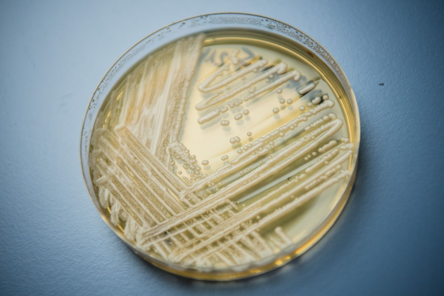 Der Hefepilz Candida auris in einer Petrischale. Die Weltgesundheitsorganisation (WHO) ist besorgt über 19 kranheitserregende Pilze, die nach Expertenansicht die öffentliche Gesundheit bed...