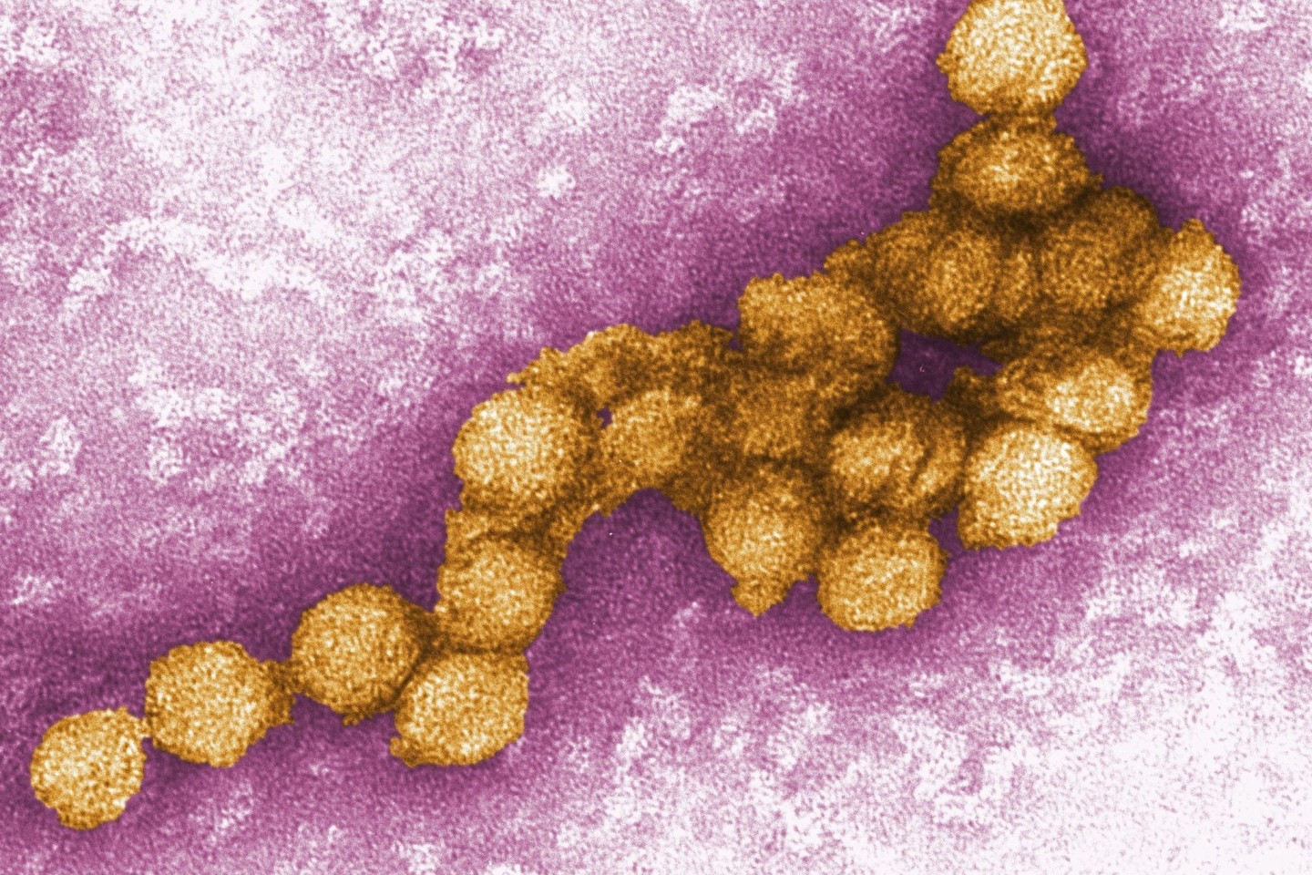 Eine elektronenmikroskopische Aufnahme des West-Nil-Virus.